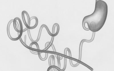 Quelles sont les meilleures astuces pour restaurer sa flore intestinale ?